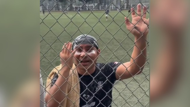 Penyanyi Judika pakai odol di bawah mata latihan bersama Selebritis FC akibat gas air mata yang terbawa angin di kawasan Senayan, Jakarta, Senin (25/8/2025). [Instagram]